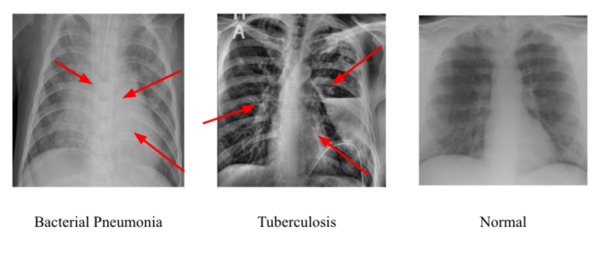 determining-the-best-convolutional-neural-network-for-identifying